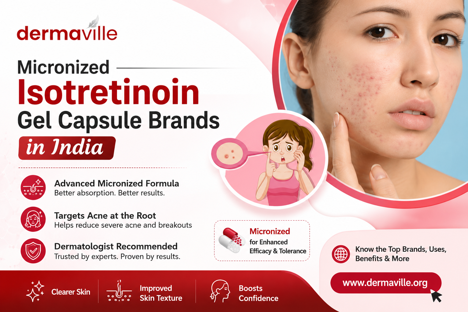 Micronized Isotretinoin gel capsule Brands in India